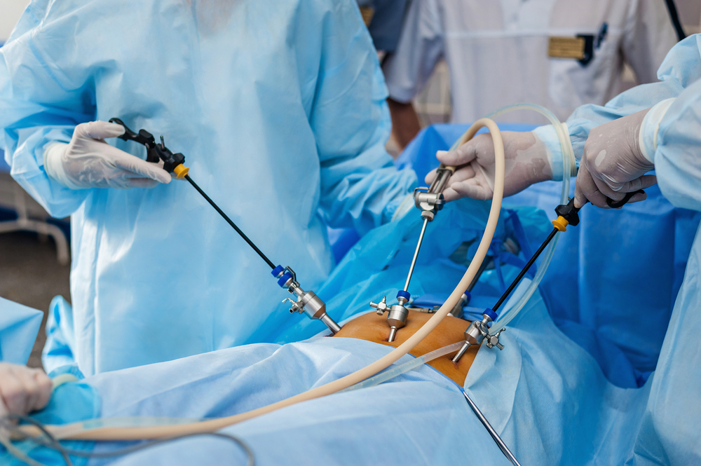 Successful-Laparoscopic-Surgery